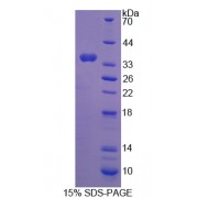 SDS-PAGE analysis of C-Ros Oncogene 1, Receptor Tyrosine Kinase Protein.