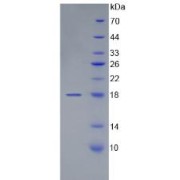 SDS-PAGE analysis of vWF Protein.