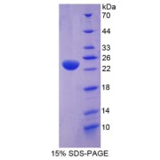 SDS-PAGE analysis of TEK Protein.