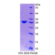 SDS-PAGE analysis of Dynamin 2 Protein.