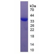 SDS-PAGE analysis of Serum Response Factor Protein.