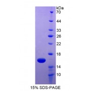 SDS-PAGE analysis of Carcinoembryonic Antigen Related Cell Adhesion Molecule 6 Protein.