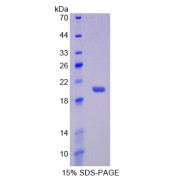 SDS-PAGE analysis of IL17RB Protein.