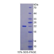 SDS-PAGE analysis of Canopy 2 Homolog Protein.