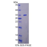 SDS-PAGE analysis of Neuropilin 2 Protein.