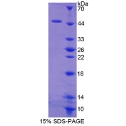 SDS-PAGE analysis of recombinant Human Hemoglobin Delta (HBd) Protein.