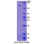 SDS-PAGE analysis of Tubulin epsilon Protein.