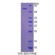 SDS-PAGE analysis of Pygopus Homolog 2 Protein.