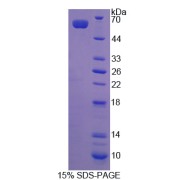 SDS-PAGE analysis of Serine Hydroxymethyltransferase 2, Mitochondrial Protein.