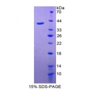 SDS-PAGE analysis of CXCL2 Protein.