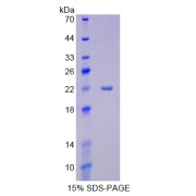 SDS-PAGE analysis of recombinant Human CYP3A4 Protein.