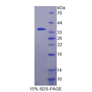 SDS-PAGE analysis of Fidgetin Protein.