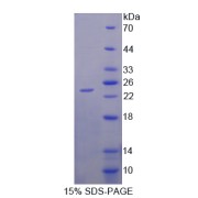 SDS-PAGE analysis of Human CITED1 Protein.