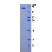 SDS-PAGE analysis of recombinant Human Farnesoid X Receptor Protein.