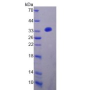 SDS-PAGE analysis of Cytochrome b-245 beta Polypeptide Protein.