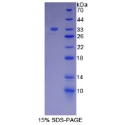 SDS-PAGE analysis of V-Erb B2 Erythroblastic Leukemia Viral Oncogene Homolog 3 Protein.