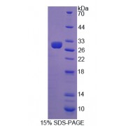 SDS-PAGE analysis of Interferon alpha/beta Receptor 2 Protein.