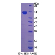 SDS-PAGE analysis of Proprotein Convertase Subtilisin/Kexin Type 5 Protein.