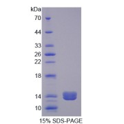 SDS-PAGE analysis of PLOD2 Protein.