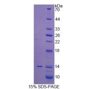 SDS-PAGE analysis of PLOD3 Protein.