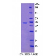 SDS-PAGE analysis of Protease, Serine 12 Protein.
