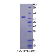 SDS-PAGE analysis of recombinant Human ASGR2 Protein.