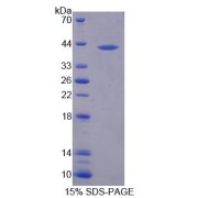 SDS-PAGE analysis of recombinant Human Melanotransferrin Protein.