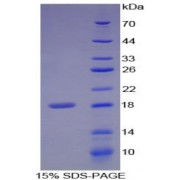 SDS-PAGE analysis of Matrix Metalloproteinase 3 (MMP3) Protein.