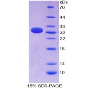 SDS-PAGE analysis of FMS Like Tyrosine Kinase 3 Protein.