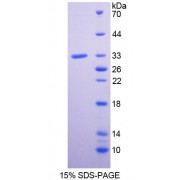 SDS-PAGE analysis of Plexin A1 Protein.