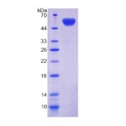 SDS-PAGE analysis of Cadherin-11 Protein.