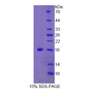 SDS-PAGE analysis of Response Gene To Complement 32 Protein.