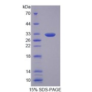 SDS-PAGE analysis of Absent In Melanoma 1 Protein.