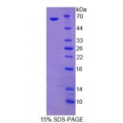 SDS-PAGE analysis of Ephrin Type A Receptor 4 Protein.