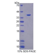 SDS-PAGE analysis of Oxidative Stress Induced Growth Inhibitor 1 Protein.