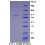 SDS-PAGE analysis of CYP27B1 Protein.