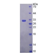 SDS-PAGE analysis of recombinant Human Plectin (PLEC) Protein.