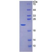 SDS-PAGE analysis of IL7 Protein.