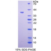 SDS-PAGE analysis of Arachidonate-12-Lipoxygenase Protein.