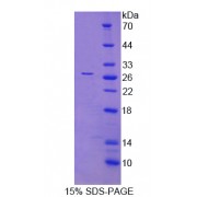 SDS-PAGE analysis of HLA Class II Histocompatibility Antigen, DRB1 Beta Chain Protein.