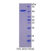 SDS-PAGE analysis of Complement Component 8g Protein.