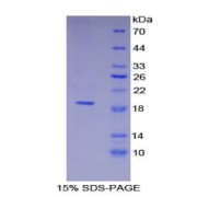 SDS-PAGE analysis of Thrombomodulin Protein.