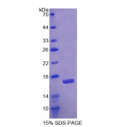 SDS-PAGE analysis of Agmatine Ureohydrolase Protein.