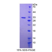 SDS-PAGE analysis of Human PTGS1 Protein.