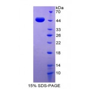 SDS-PAGE analysis of Growth Differentiation Factor 2 Protein.