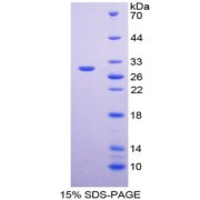 SDS-PAGE analysis of recombinant Mouse SERPINA3 / a1ACTn Protein.