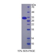 SDS-PAGE analysis of MBL2 Protein.