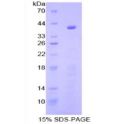 SDS-PAGE analysis of Nuclear Factor kappa B Protein.