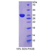 SDS-PAGE analysis of recombinant Mouse COL1A2 Protein.