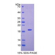 SDS-PAGE analysis of Galectin 7 Protein.